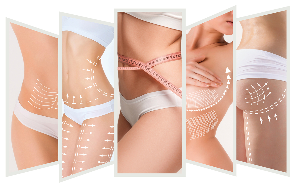 Body lift Tunisie : Transformez votre silhouette avec des experts